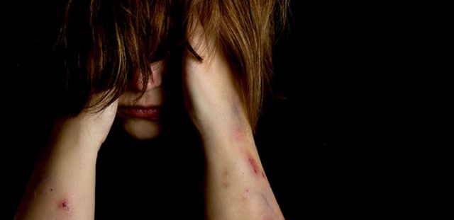 Can Victims Claim Compensation